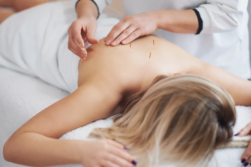 acupuncture treatment in Edmonton for pain, stress, and insomnia