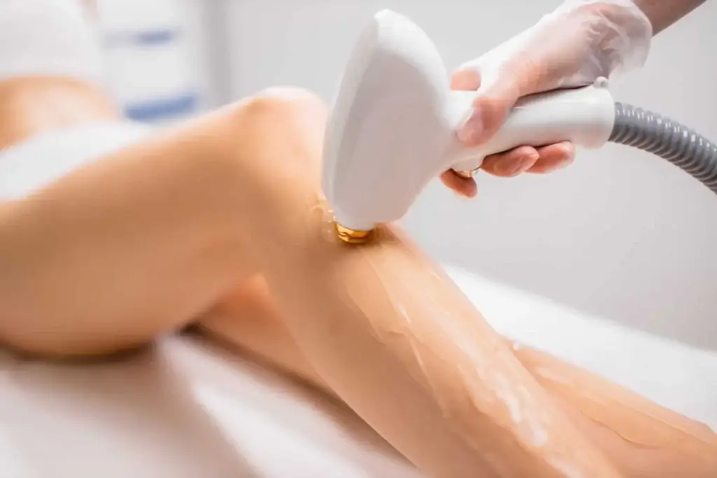 laser treatment company in Edmonton