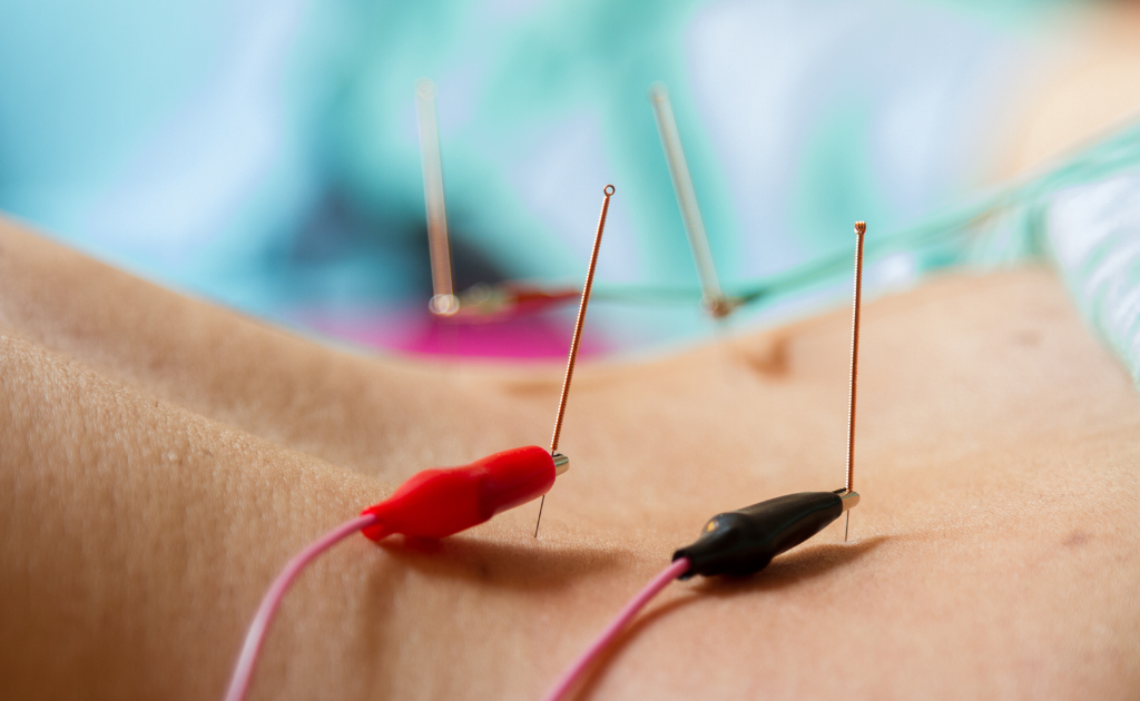 Gentle electrical acupuncture